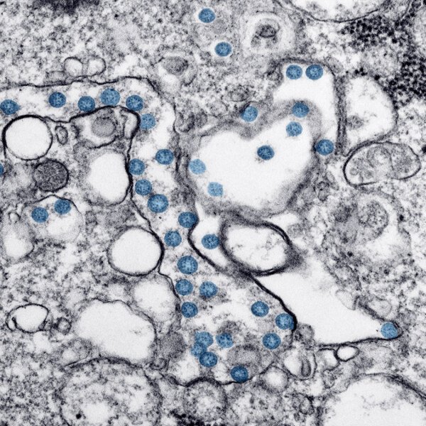 Canada Tightens Border Rules Over Ebola Concerns - What Travellers Need to Know