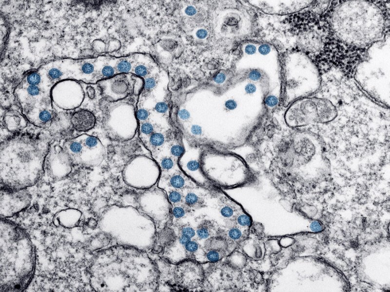 Canada Tightens Border Rules Over Ebola Concerns – What Travellers Need to Know