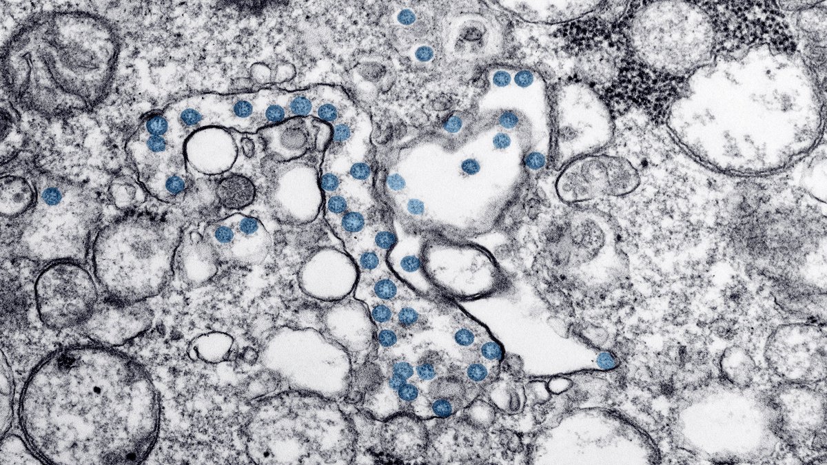 Canada Ebola travel rules